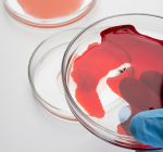 Especialista da BP relata o que é verdadeiro ou falso sobre as doenças hematológicas no Brasil