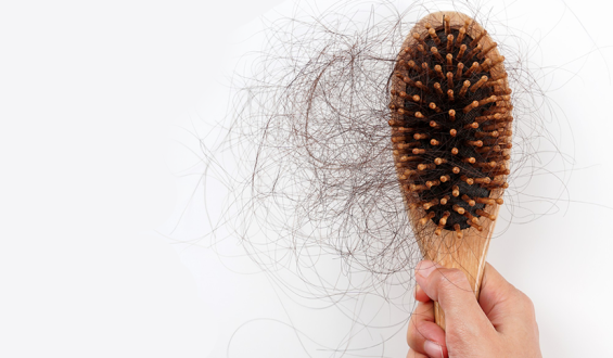 Queda de cabelo: entenda quando é normal e quais são os sinais de alerta