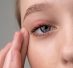 Temperaturas elevadas no verão contribuem para novos casos de terçol