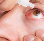 Conjuntivite: calor, piscina e descuido explicam o aumento dos casos