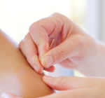 Dia Nacional de Combate às Drogas e ao Alcoolismo: Acupuntura como Complemento no Tratamento da Dependência Química