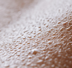 Medir glicose pelo suor? Calma: isso ainda é ficção, diz Sociedade Brasileira de Diabetes