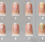 Formato e cor das unhas: O que eles podem indicar sobre a sua saúde