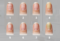 Formato e cor das unhas: O que eles podem indicar sobre a sua saúde