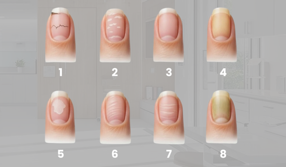 Formato e cor das unhas: O que eles podem indicar sobre a sua saúde
