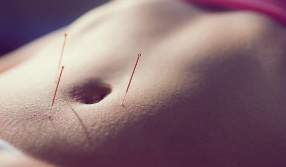 Endometriose em foco no Março Amarelo: Acupuntura como aliada no tratamento