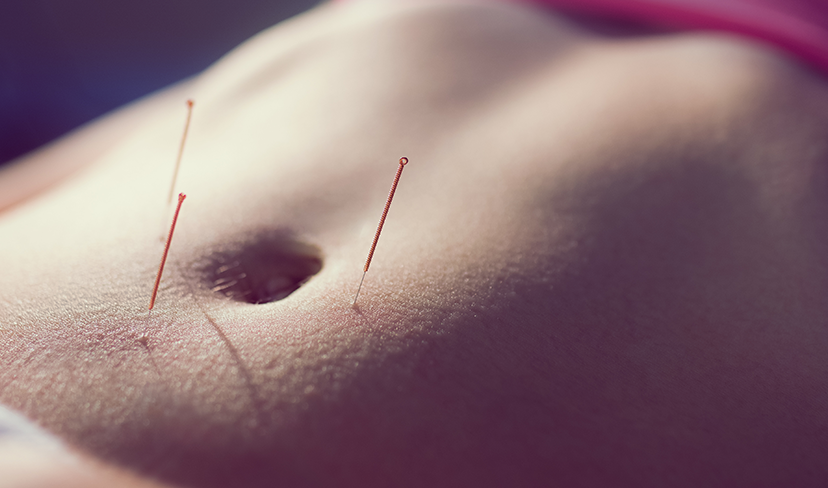 Endometriose em foco no Março Amarelo: Acupuntura como aliada no tratamento