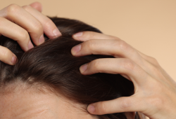 Penteados apertados podem causar dor de cabeça e até queda de cabelo; Entenda os riscos