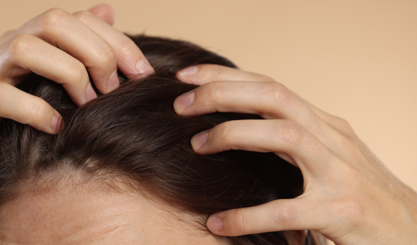 Penteados apertados podem causar dor de cabeça e até queda de cabelo; Entenda os riscos