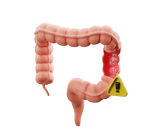 Doença de Crohn em crianças: estudo chama atenção para diagnóstico tardio