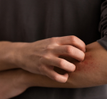 Sua pele arde, pinica, fica vermelha? Faça o teste e saiba se ela é sensível