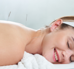 Saiba como a acupuntura ajuda a saúde feminina em todas as fases da vida