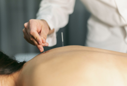 CFM promove fórum para discutir impactos da nova Lei da Acupuntura na prática médica e na segurança do paciente