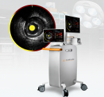 Tecnologia já disponível no Brasil ajuda a identificar pacientes com maior risco de infarto antes do aparecimento dos sintomas