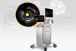 Tecnologia já disponível no Brasil ajuda a identificar pacientes com maior risco de infarto antes do aparecimento dos sintomas