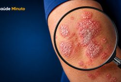 Sua pele sofre no frio? O inverno pode estar por trás disso