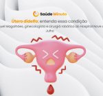 Você já ouviu falar em útero didelfo?
