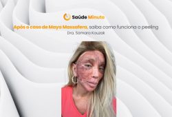 Após o caso de Maya Massafera, saiba como funciona o peeling