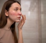Muito além da estética: entenda o que é a celulite facial e por que ela exige atenção