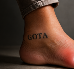 Acordou com o dedão do pé pegando fogo? Pode ser gota