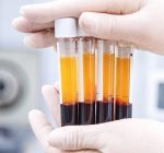 CFM aprova uso do plasma rico em plaquetas para tratar condições ósseas, musculares e articulares