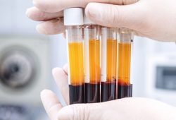 CFM aprova uso do plasma rico em plaquetas para tratar condições ósseas, musculares e articulares