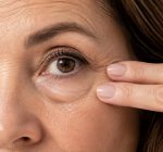 Blefaroplastia: 6 mitos e verdades para quem pensa em fazer a cirurgia