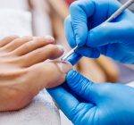 Unha encravada tem cirurgia? Entenda como funciona a cantoplastia