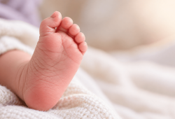 Um detalhe nos pés do bebê pode revelar uma doença rara